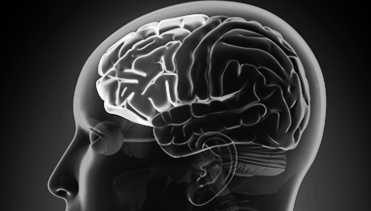 손실 회피 성향4