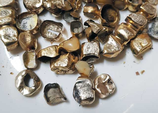 금니 팔기 전 시세 확인하기