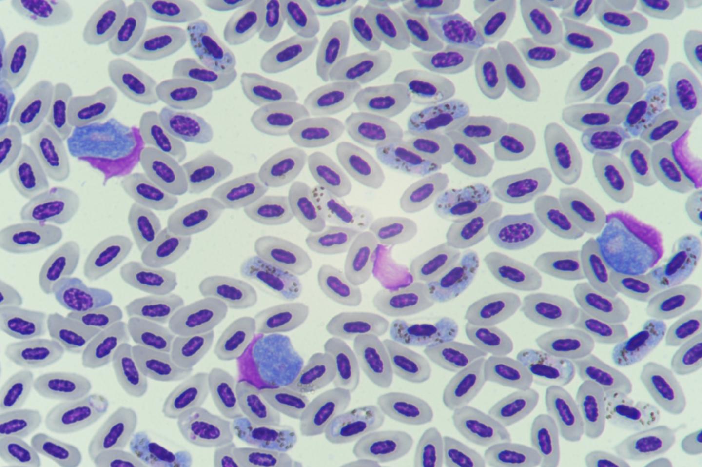 벌레가 옮기는 전염병
