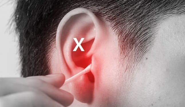 귀지를 자동으로 빼주는 '헤드폰 타입 시스템' VIDEO:Bizarre headphones promise to deep clean your ears in 35 secondsㅣ 귀 팔 때 면봉을 사용하면 안되는 이유