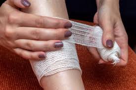 bleeding control