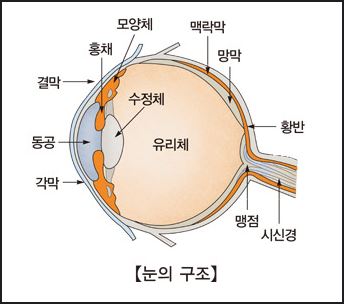 망막 박리 증상