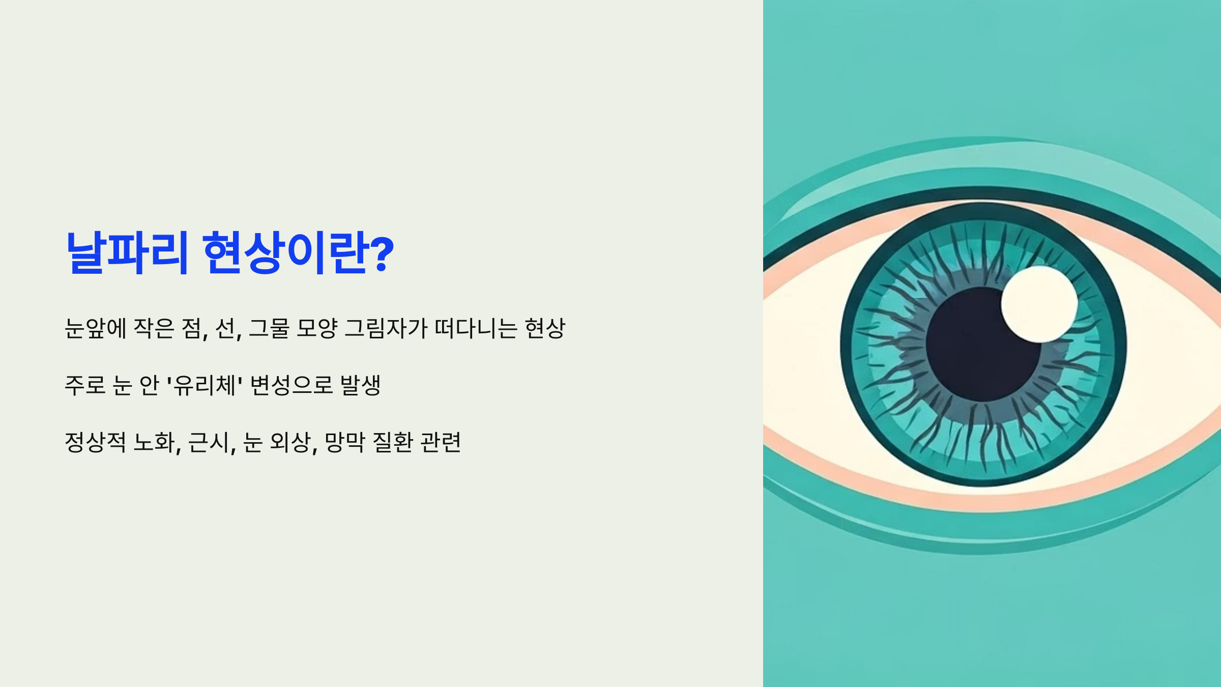 날파리 현상이란? (비문증의 이해)