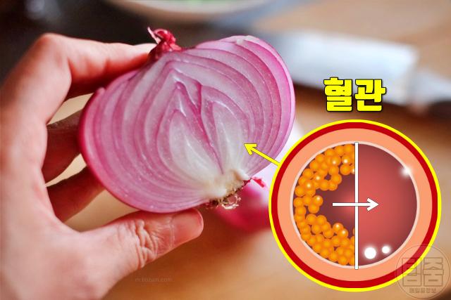 혈액순환영양제 추천 혈관에 좋은 음식 양파