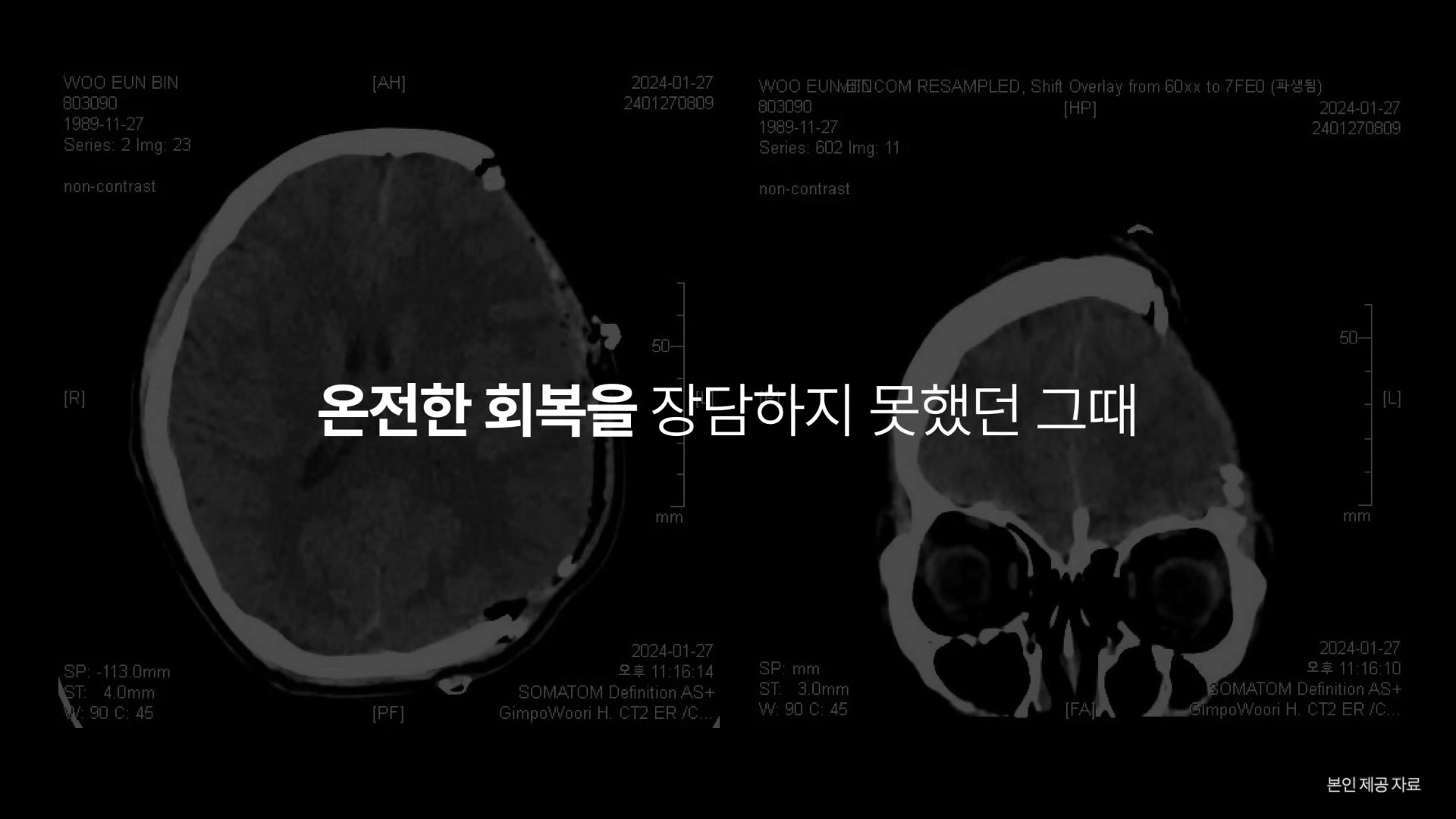 온전한 회복을 장담하지 못했던 그때