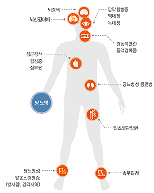 당뇨병 초기증상