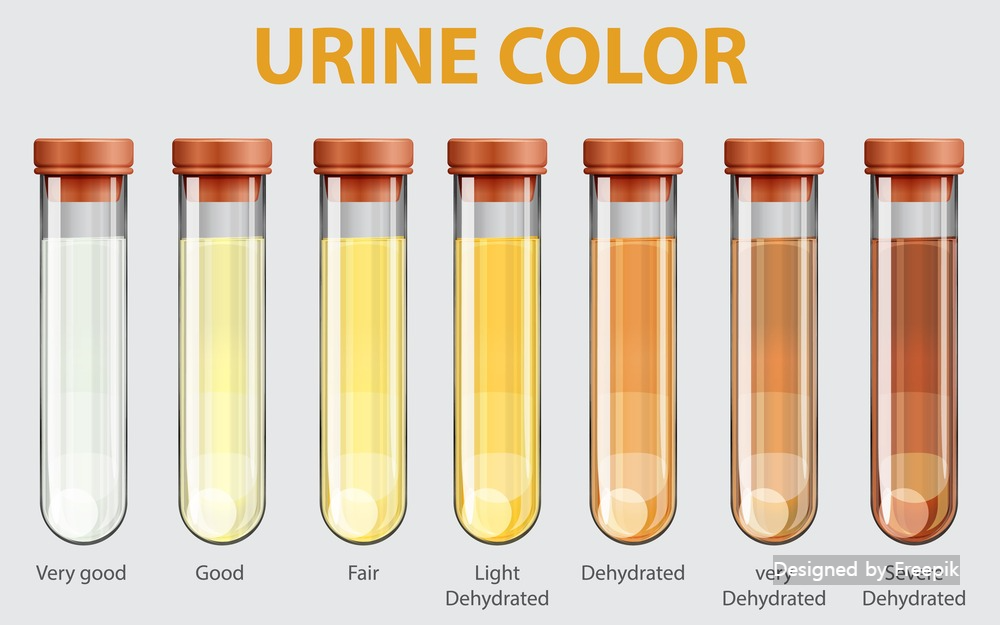 소변 거품 증상