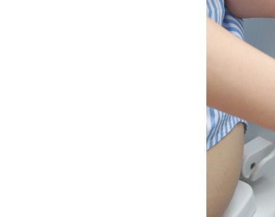 과민성 대장증후군 증상