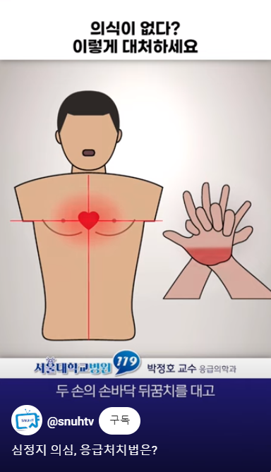 심폐소생술