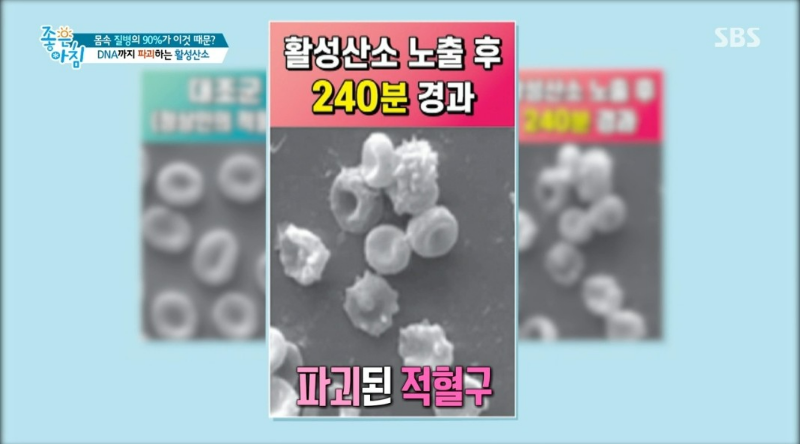 숨만 쉬어도 활성 산소가 생긴다?