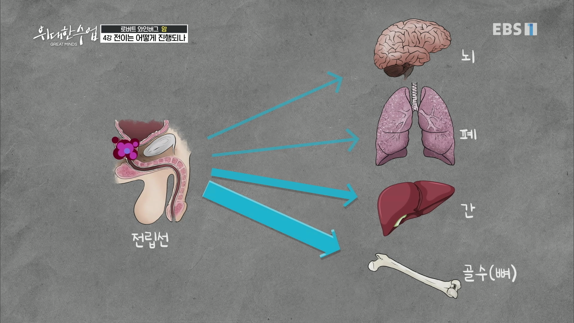 전립선암 전이 기관