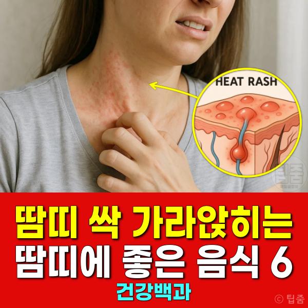 땀띠에 좋은 음식