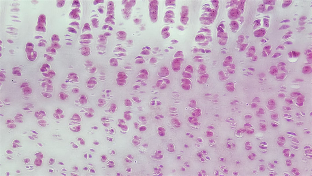 'Cells'