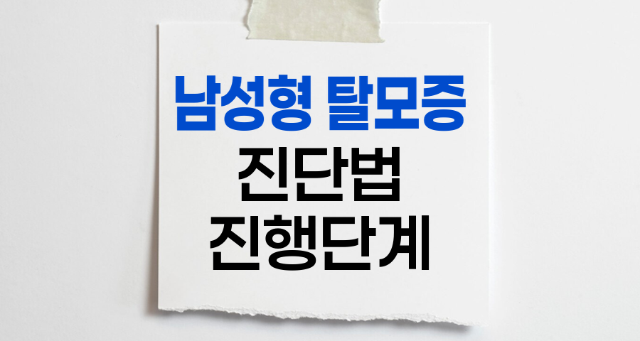 남성형 탈모증 진단법과 진행 단계