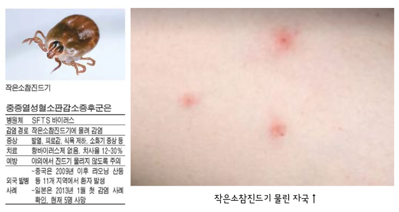 진드기 사진 및 물렸을때 발진 양상입니다.
