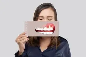 치아