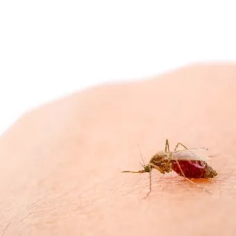 모기 물렸을 때 가려움증 없애는 법 효과적인 민간요법_16