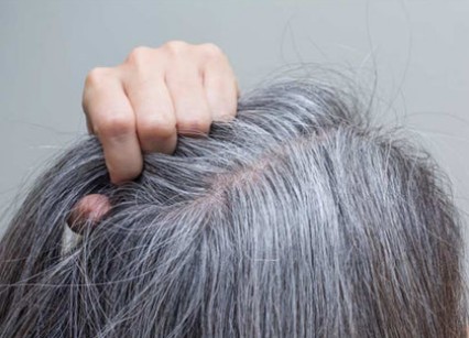 흰머리, 새치 예방에 좋은 루테올린 효능 효과
