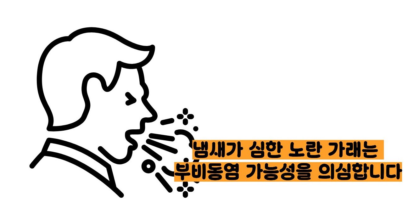 가래가 노란색