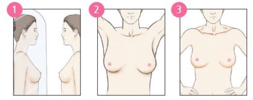 유방암 자가검진 1단계 - 거울 앞에서 다양한 자세로 유방 모양 변화 관찰하기