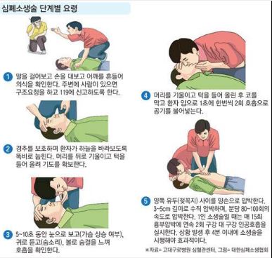 심폐소생술