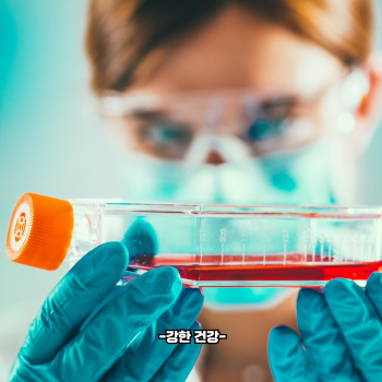 혈뇨가 나오는 이유