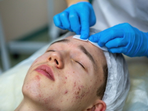 여드름 흉터 없애는법