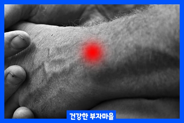 타이핑과 같은 반복적인 활동 시 통증