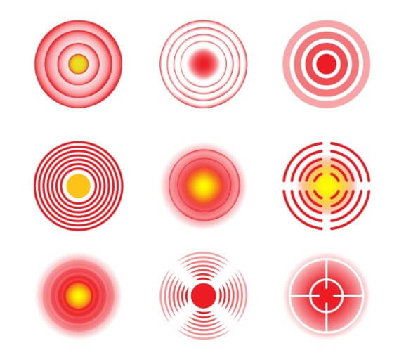 혈관에 지방으로 막혀 있는 모습
