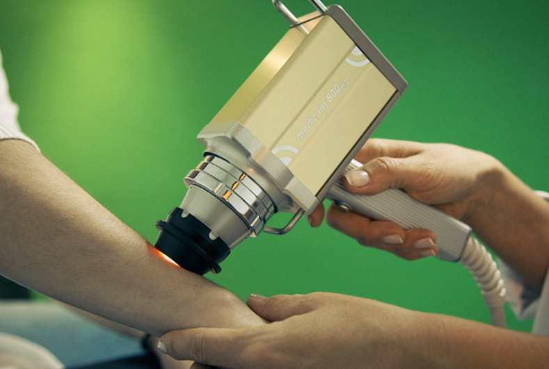 교차 증후군, 과도한 근육 사용으로 인해 발생하는 근육 불균형(상부 교차 증후군, 하지 교차 증후군)