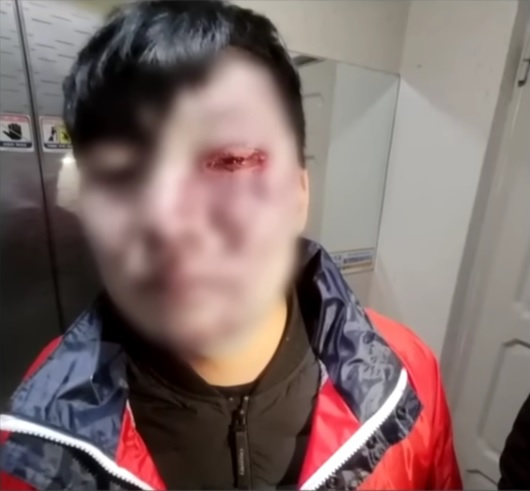 배달원 A씨의 폭행 당한 이후 사진 [사진=사건반장 캡쳐]