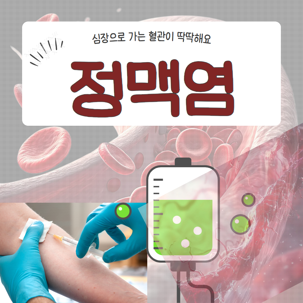 정맥염