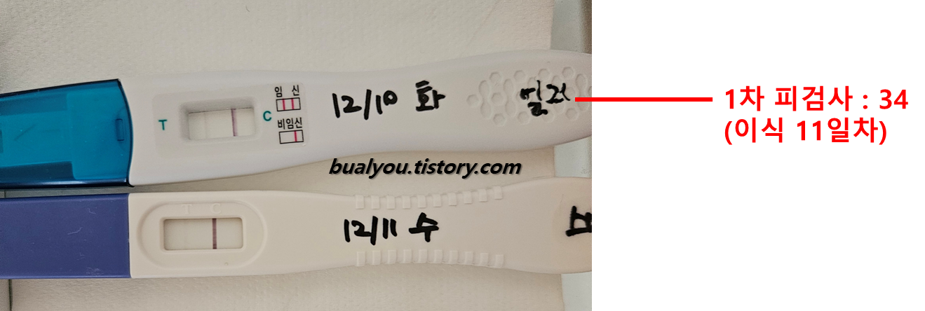 동아 얼리, 스마일 임신 테스트기 피검사 수치