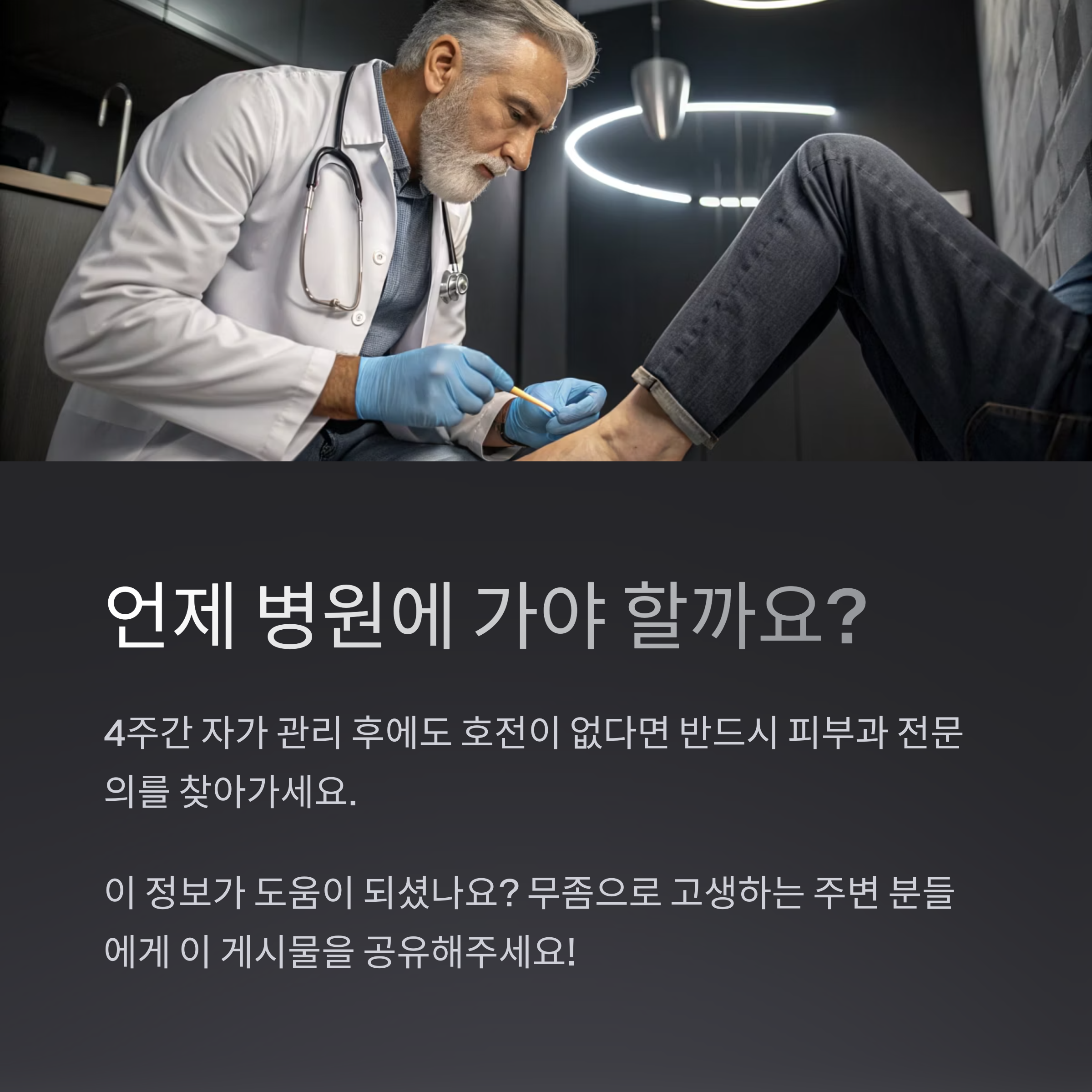 손발톱 무좀, 약 없이도 관리로 개선