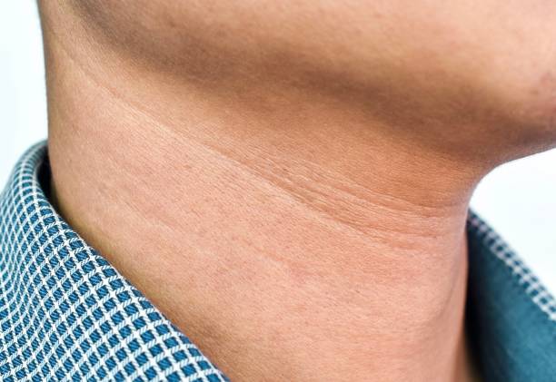 갑상선항진증의 원인과 증상