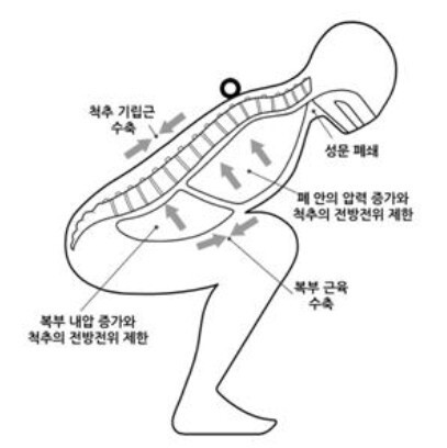 발살바