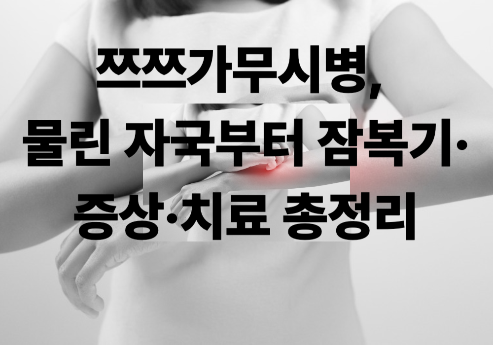 쯔쯔가무시병, 물린 자국부터 잠복기·증상·치료까지 총정리