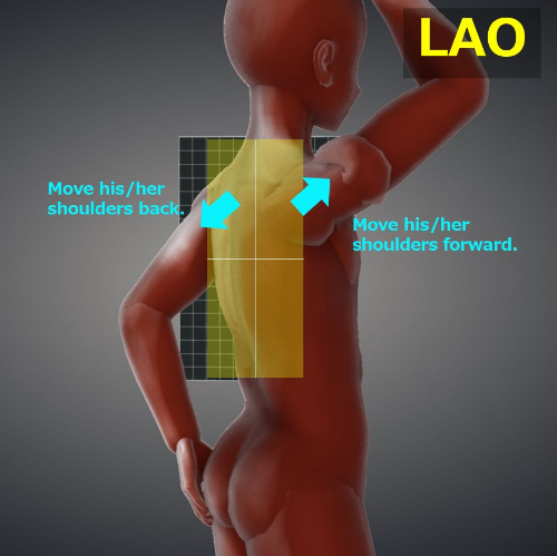 t-spine oblique 촬영법