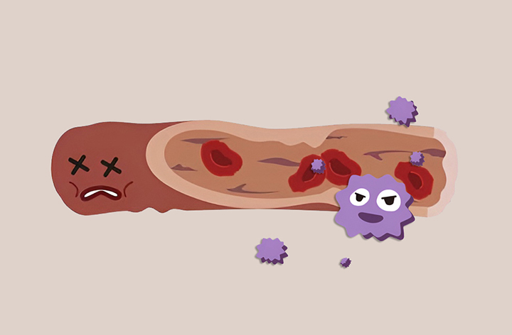 혈액-순환에-문제가-있는-혈관