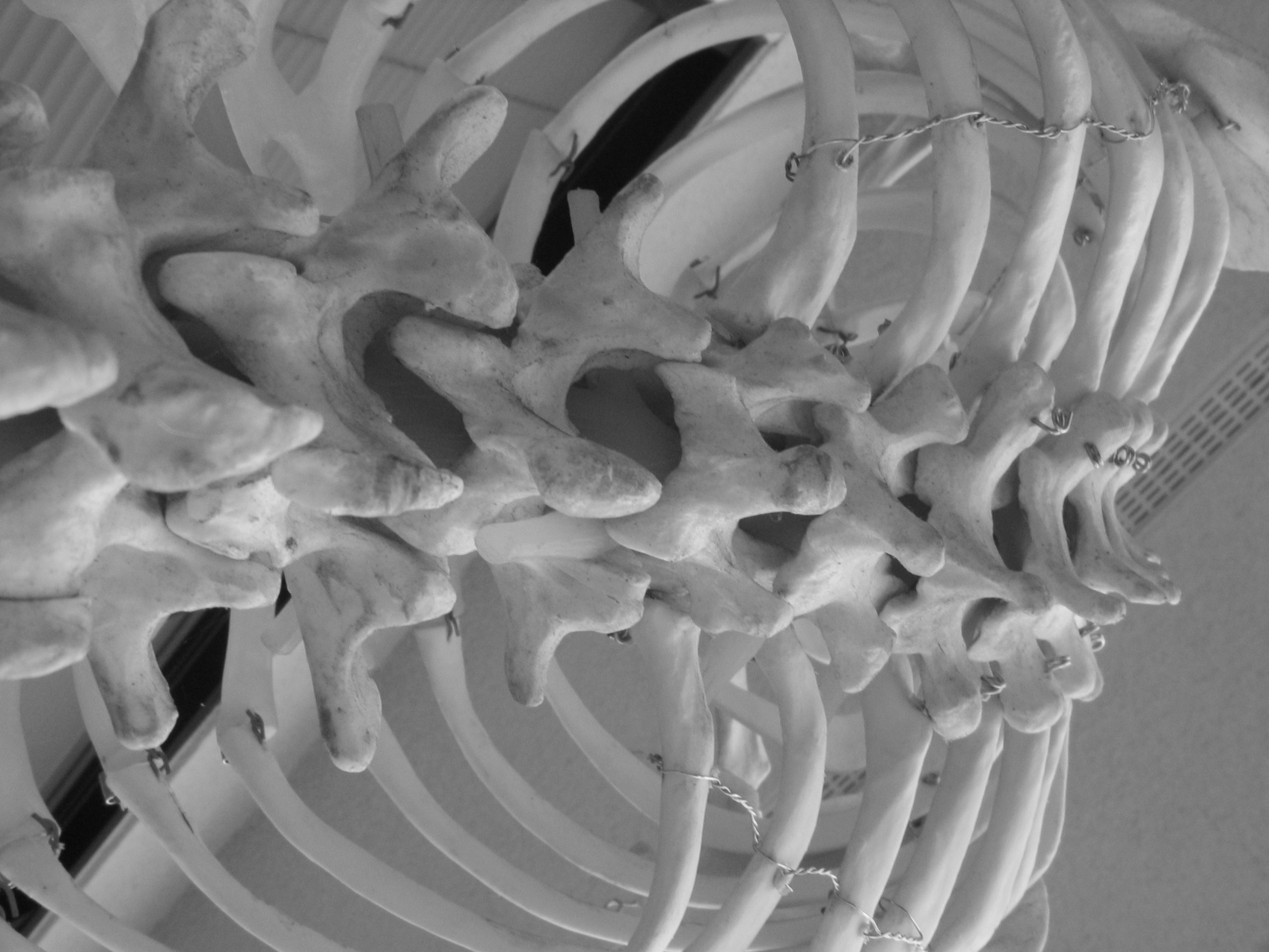 흉추 골격 모습