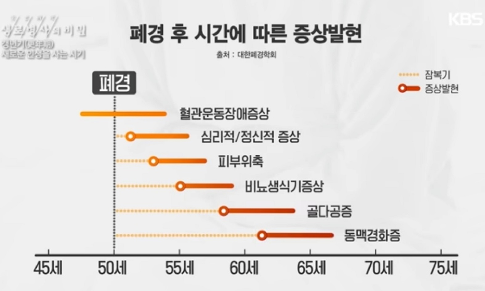 갱년기-호르몬제-먹을까-말까-산부인과-이지영-교수