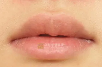 입술 두꺼운 남자 관상 특징과 해석_9