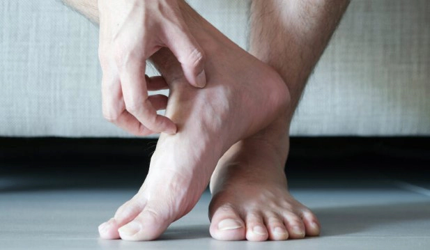 무좀 습진 구별 방법