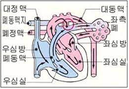 동맥관 개존증 산정특례