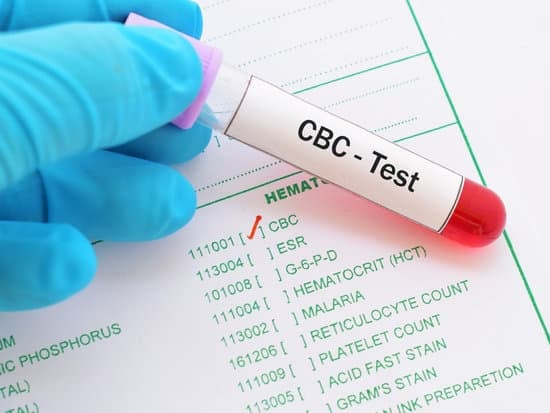 일반 혈액 검사 (CBC, Complete Blood Count)