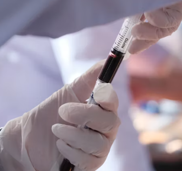 빈혈 증상 원인 치료 방법