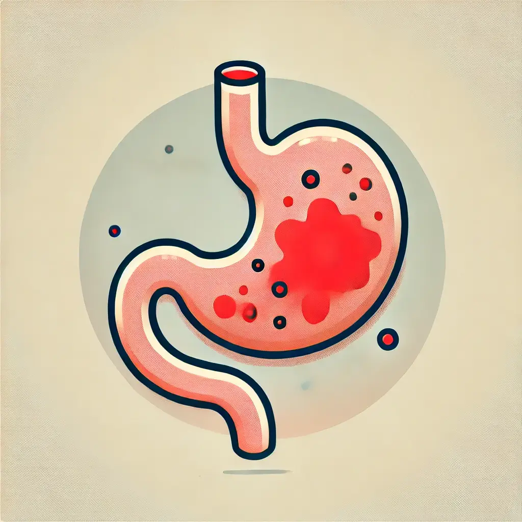 위암 증상 및 치료법