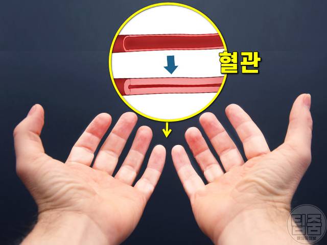 손발이 찬 이유,손발이 찬 체질,수족냉증