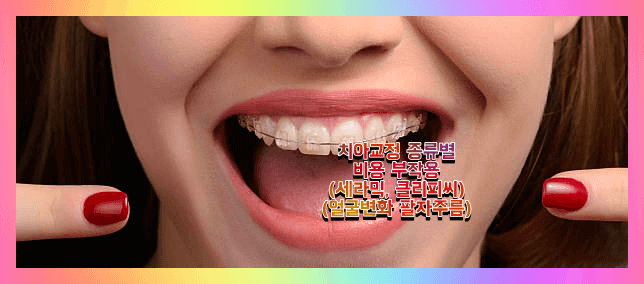 치아교정 종류 비용 부작용