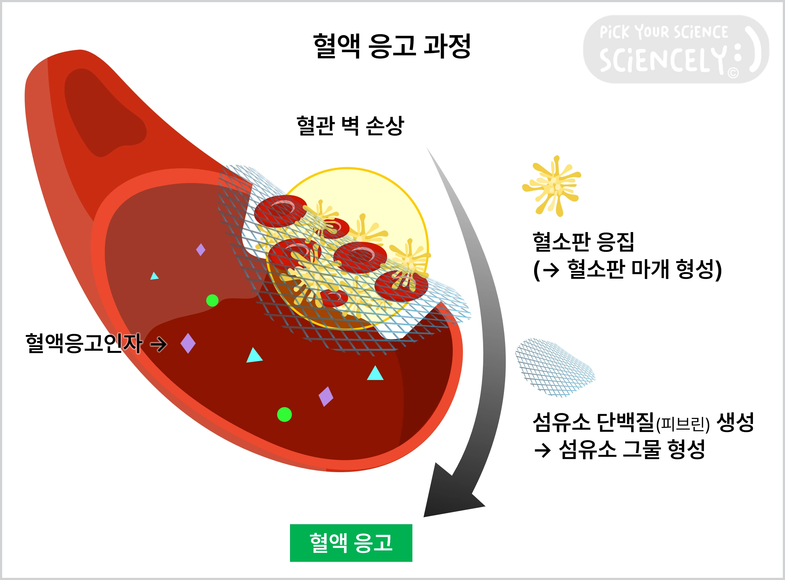 혈액 응고 과정, 혈관 벽 손상, 혈소판 응집, 혈소판 마개, 섬유소 단백질, 피브린, 섬유쇼 그물, 혈병, 혈액 응고 인자